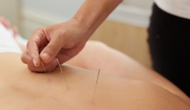 Dry-needling