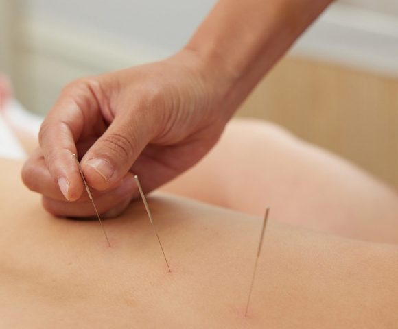 Remedial Massage vs Myotherapy Malvern East | Which is Right for You?